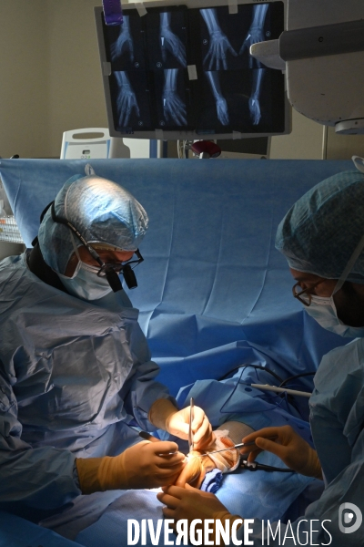 Chirurgie de la main -Implantation d une prothèse miniature pour le traitement de l arthrose de la main ou du poignet, par le Docteur Cristian COUTURIER à la clinique Arago à Paris