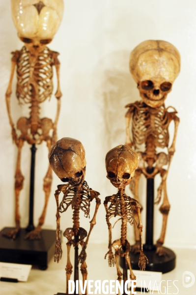 Collection de l Institut d Anatomie Normale de Strasbourg