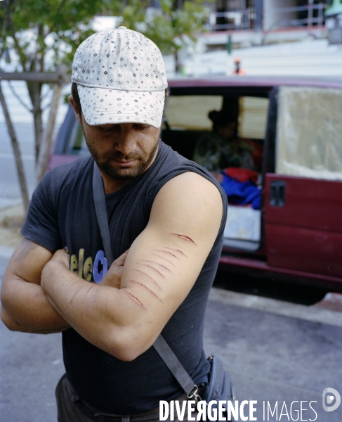 Jeune homme scarifié, Porte d Aubervilliers, Paris