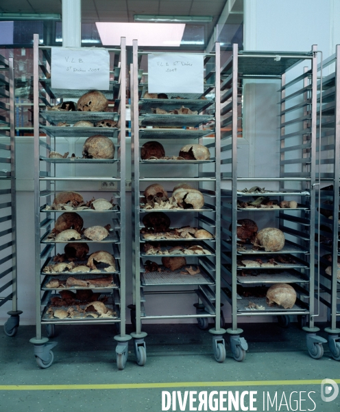 Nettoyage d ossements humains issus de fouilles archéologique