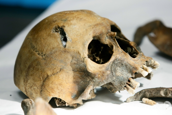 Procédure d identification du cadavre d un poilu par le docteur Bruno Frémont