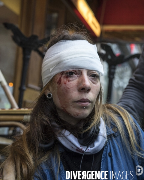 Gilet jaune blessée au front par un tir de flashball de la police, Paris
