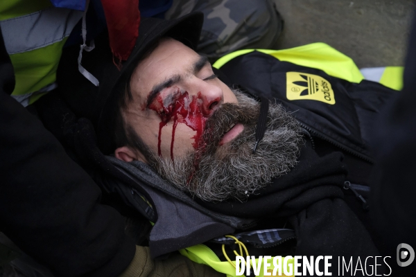 Jerome Rodrigues, Gilets Jaunes, Yellow Vest, acte XII Paris.