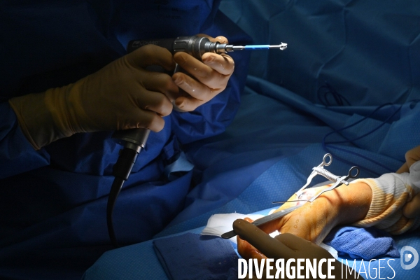 Chirurgie de la main -Implantation d une prothèse miniature pour le traitement de l arthrose de la main ou du poignet, par le Docteur Cristian COUTURIER à la clinique Arago à Paris