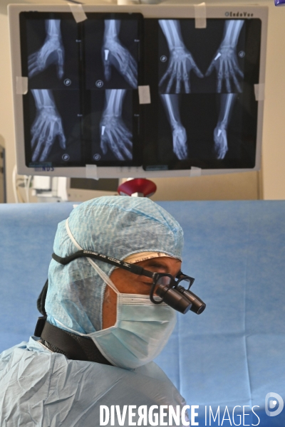 Chirurgie de la main -Implantation d une prothèse miniature pour le traitement de l arthrose de la main ou du poignet, par le Docteur Cristian COUTURIER à la clinique Arago à Paris