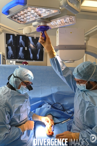 Chirurgie de la main -Implantation d une prothèse miniature pour le traitement de l arthrose de la main ou du poignet, par le Docteur Cristian COUTURIER à la clinique Arago à Paris