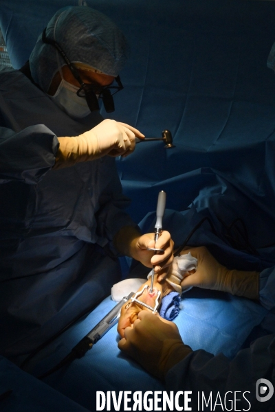 Chirurgie de la main -Implantation d une prothèse miniature pour le traitement de l arthrose de la main ou du poignet, par le Docteur Cristian COUTURIER à la clinique Arago à Paris