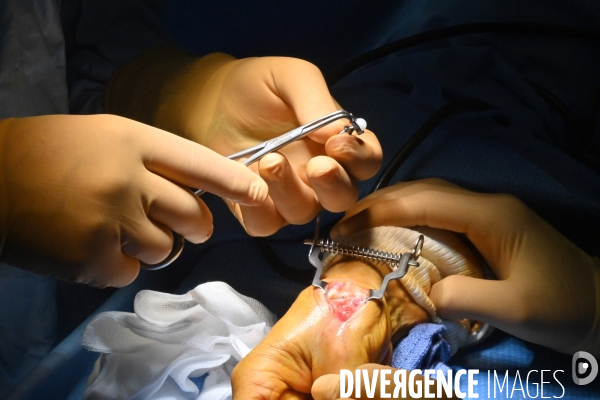 Chirurgie de la main -Implantation d une prothèse miniature pour le traitement de l arthrose de la main ou du poignet, par le Docteur Cristian COUTURIER à la clinique Arago à Paris