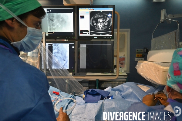 Radiologie interventionnelle - CHU de Bordeaux