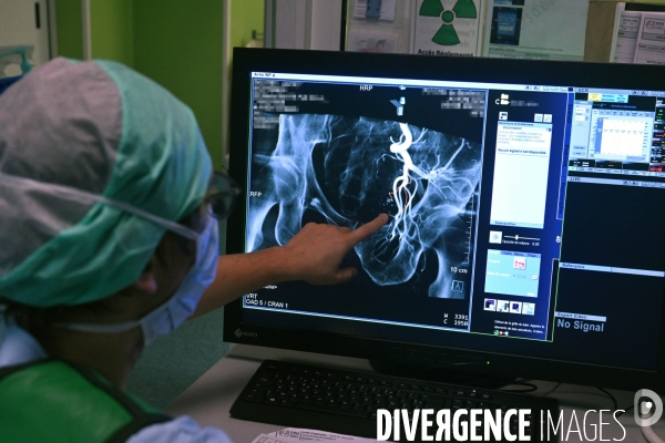 Radiologie interventionnelle - CHU de Bordeaux