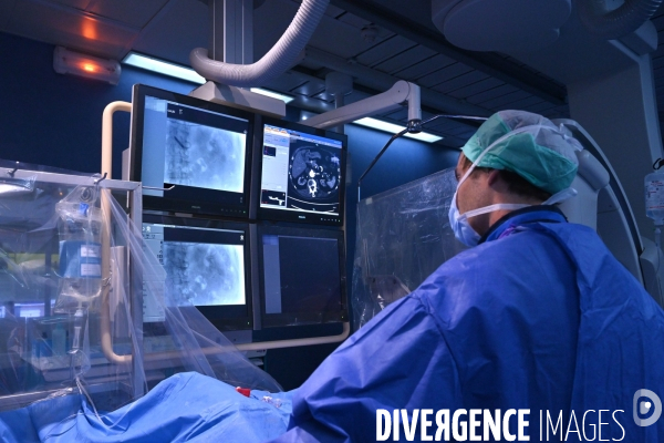 Radiologie interventionnelle - CHU de Bordeaux