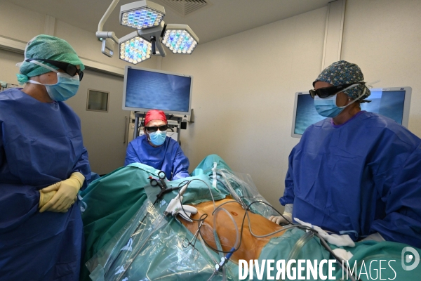 Chirurgie de l endométriose -  Au centre d Endométriose de la clinique TIVOLI DUCOS  de Bordeaux , dirigé par le professeur Horace ROMAN