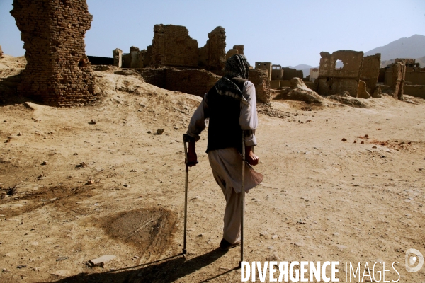 The Scars of the Afghanistan War. Les cicatrices de la guerre d Afghanistan.