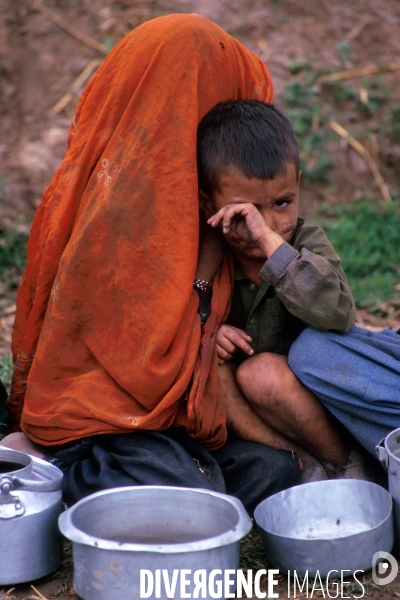 The Scars of the Afghanistan War. Les cicatrices de la guerre d Afghanistan.