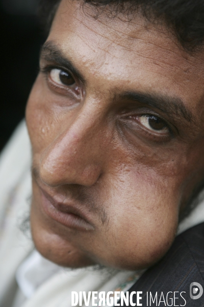 Le khat au yemen