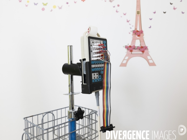 Crises Epileptiques non Pathogenes