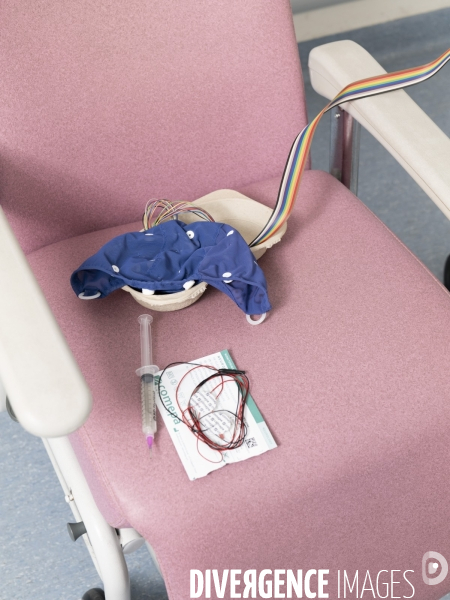 Crises Epileptiques non Pathogenes