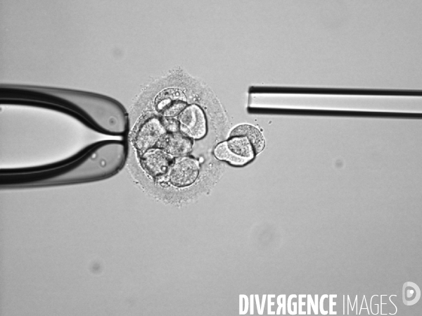 Laboratoire de diagnostic préimplantatoire