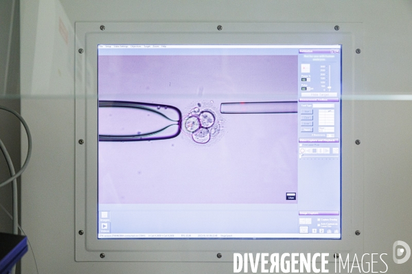 Laboratoire de diagnostic préimplantatoire