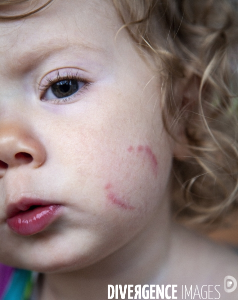 ENFANCE-crèche-violence