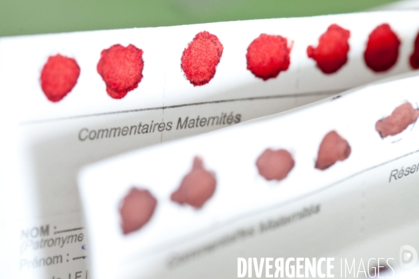 Maternite - Test de Guthrie