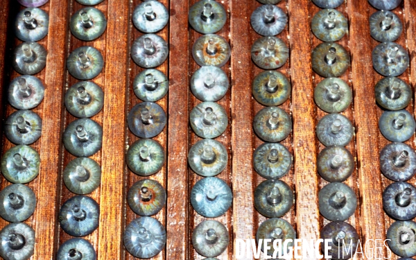 Fabrication d une prothese oculaire