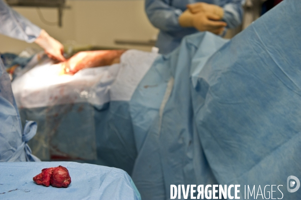 Interventions chirurgicales pratiquees avec une assistance robotique