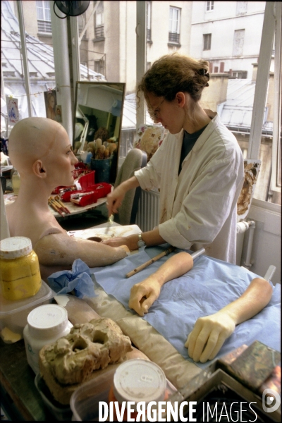 Fabrication d une prothese oculaire