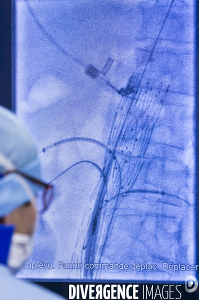 1ere mondiale: salle hybride de chirurgie cardiovasculaire au CHRU de Lille. (version couleur)