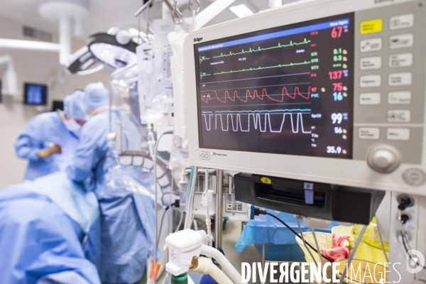 1ere mondiale: salle hybride de chirurgie cardiovasculaire au CHRU de Lille. (version couleur)