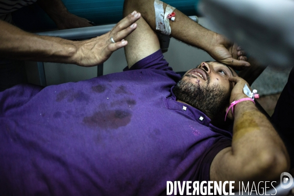 Injured pro Morsis from confrontation with army, Cairo