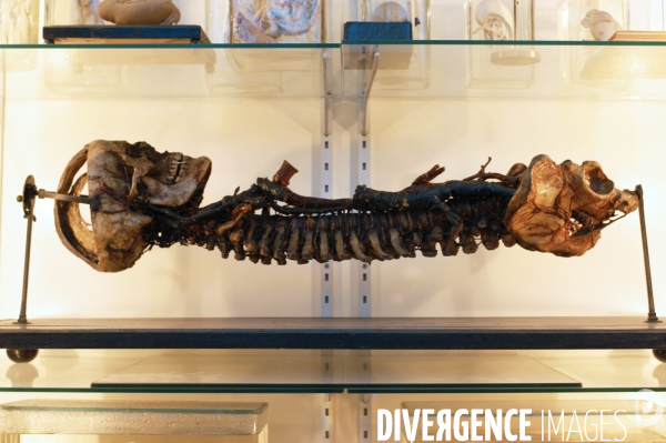 Collection de l Institut d Anatomie Normale de Strasbourg