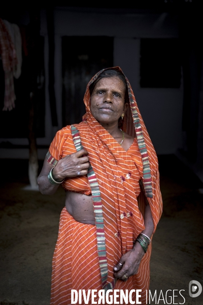 Inde : catastrophe de Bhopal, 30 ans après